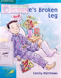 Image of Cambridge : steve's broken leg